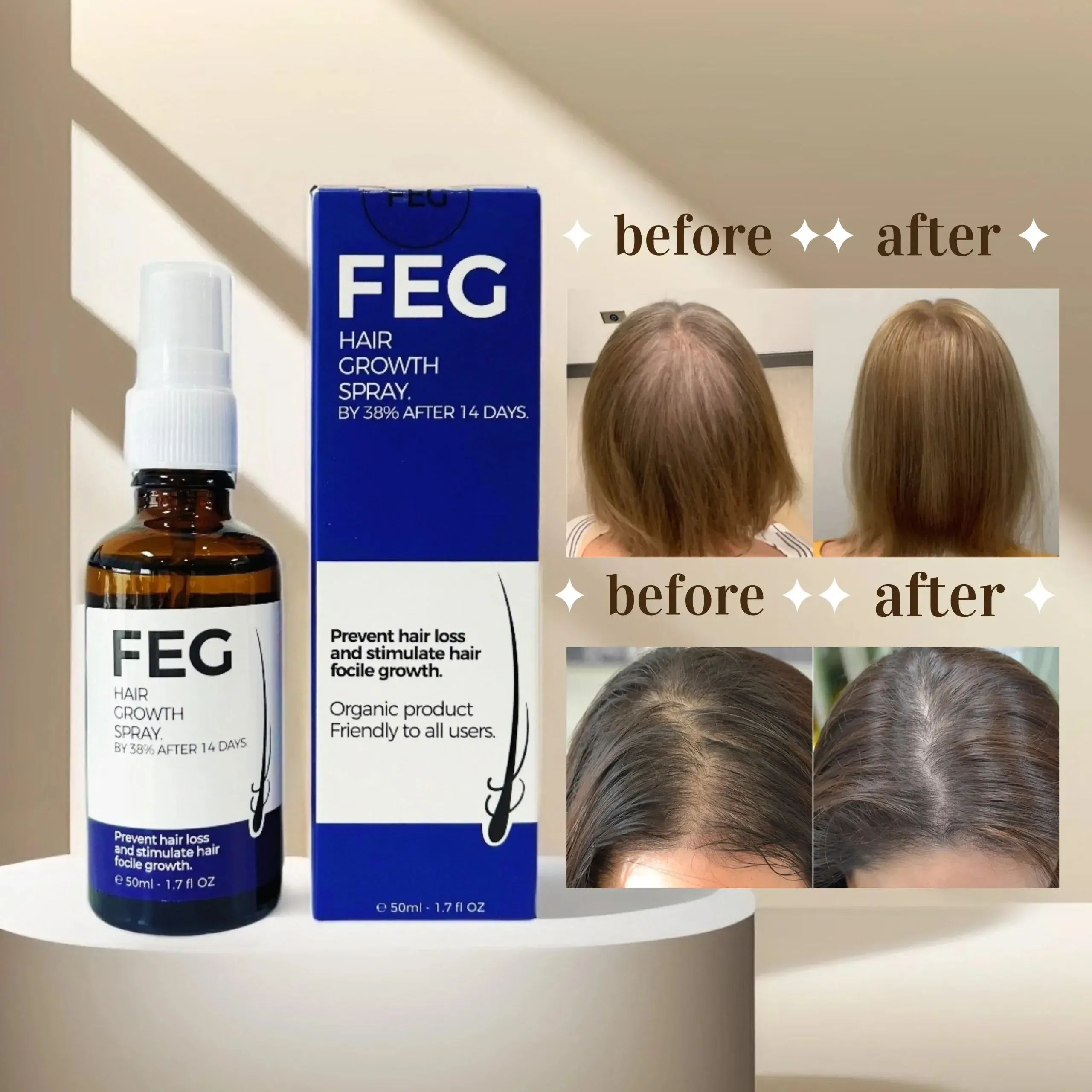 6dbe00ec906a12ee70aca33885825697.webp FEG PLUS Hair & Beard Regrowth Spray 50ml – Anti Hair Loss Formula with Minoxidil, Redensyl & Natural Extracts - Image 1