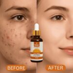 Relax Vitamin C Daily Face Serum – Brightening, Anti-Aging & Hydrating Formula For Healthy Radiant Skin (30ml)