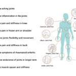 Sukoon Joint On Essential Oil Blend For Pain in Joints, Back Pain, Arthritis Pain, Knee Pain, Tennis Elbow, Strains and Sprains - 30ml