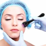 Derma roller with 540 titanium micro-needles for hair and skin therapy